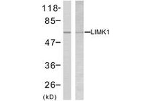 Western blot analysis of extracts from NIH-3T3 cells, treated with UV, using LIMK2 (Ab-505) Antibody. (LIMK2 抗体  (AA 471-520))