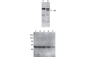 Western Blot testing of anti-BPV E2 DNaseI monoclonal antibody (5E11). (Bovine Papilloma Virus 1 E2 (BPV-1 E2) (AA 199-208) 抗体)