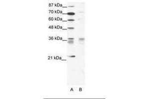 Image no. 1 for anti-BARX Homeobox 1 (BARX1) (AA 91-140) antibody (ABIN202088) (BARX1 抗体  (AA 91-140))