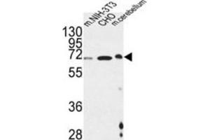 Western Blotting (WB) image for anti-Activating Transcription Factor 6 beta (ATF6B) antibody (ABIN3002237) (ATF6B 抗体)