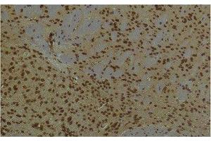 Immunohistochemistry of paraffin-embedded Mouse brain tissue using HIF1 bata Monoclonal Antibody at dilution of 1:200. (ARNT 抗体)