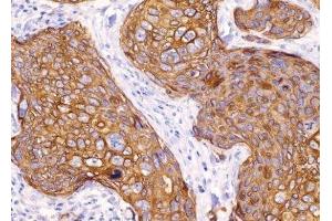Immunohistochemistry (IHC) image for anti-Keratin 16 (KRT16) (C-Term) antibody (ABIN870558) (KRT16 抗体  (C-Term))