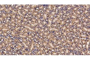 Detection of CBX3 in Mouse Kidney Tissue using Polyclonal Antibody to Chromobox Homolog 3 (CBX3) (CBX3 抗体  (AA 1-183))