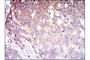 Immunohistochemistry (IHC) image for anti-CD93 (CD93) (AA 474-535) antibody (ABIN1724906)
