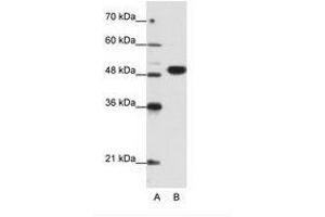 Image no. 1 for anti-Eukaryotic Translation Initiation Factor 4A2 (EIF4A2) (N-Term) antibody (ABIN6736193) (EIF4A2 抗体  (N-Term))