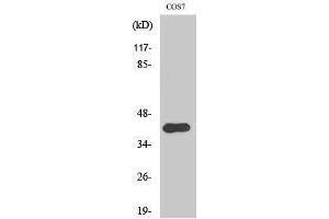 Western Blotting (WB) image for anti-V-Crk Sarcoma Virus CT10 Oncogene Homolog (Avian) (CRK) (pTyr221) antibody (ABIN3182415) (Crk 抗体  (pTyr221))