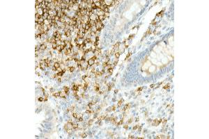 Immunohistochemistry of paraffin-embedded Human appendix using CD19 antibody (ABIN7266169) at dilution of 1:10000 (40x lens). (CD19 抗体)