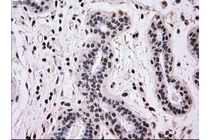 Immunohistochemical staining of paraffin-embedded breast tissue using anti-MRI1 mouse monoclonal antibody. (MRI1 抗体)
