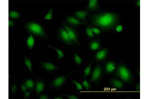 Immunofluorescence of monoclonal antibody to USP34 on HeLa cell. (USP34 抗体  (AA 3296-3395))