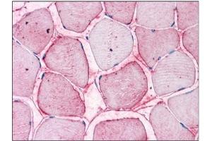Human Skeletal Muscle: Formalin-Fixed, Paraffin-Embedded (FFPE)