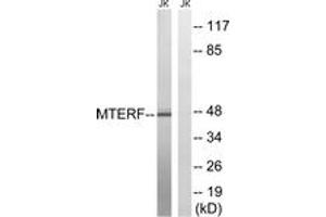 Western blot analysis of extracts from Jurkat cells, using MTERF Antibody. (MTERF 抗体  (AA 267-316))