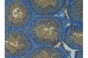 Detection of NOS2 in Mouse Testis Tissue using Polyclonal Antibody to Nitric Oxide Synthase 2, Inducible (NOS2) (NOS2 抗体  (AA 43-213))