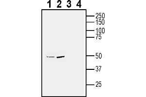 Western blot analysis of human SH-SY5Y neuroblastoma cell line lysate (lanes 1 and 3) and human  MG glioma cell line lysate (lanes 2 and 4):1-2.