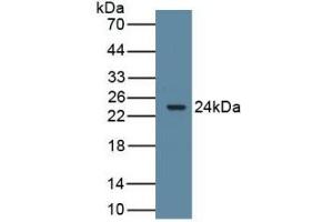 Detection of Recombinant ARO, Rat using Polyclonal Antibody to Aromatase (ARO) (Aromatase 抗体  (AA 196-373))