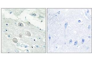 Immunohistochemistry analysis of paraffin-embedded human brain tissue, using JAK1 antibody. (JAK1 抗体  (N-Term))