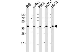 Western Blot at 1:2000 dilution Lane 1: Raji whole cell lysate Lane 2: Jurkat whole cell lysate Lane 3: K562 whole cell lysate Lane 4: MCF-7 whole cell lysate Lane 5: HL-60 whole cell lysate Lysates/proteins at 20 ug per lane.