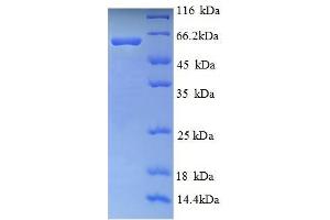 SDS-PAGE (SDS) image for Ryanodine Receptor 1 (Skeletal) (RYR1) (AA 1-534), (partial) protein (His tag) (ABIN5710288)