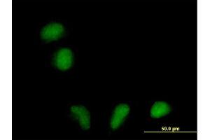 Immunofluorescence of purified MaxPab antibody to FLJ39378 on HeLa cell. (RILPL1 抗体  (AA 1-362))