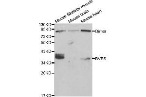 Western blot analysis of extracts of various cell lines, using BVES antibody (ABIN5970046) at 1/1000 dilution. (BVES 抗体)