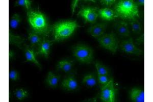 Anti-KRT8 mouse monoclonal antibody (ABIN2452366) immunofluorescent staining of COS7 cells transiently transfected by pCMV6-ENTRY KRT8 (RC209570). (KRT8 抗体  (AA 91-381))