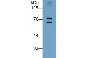 Detection of PADI6 in Human Placenta lysate using Monoclonal Antibody to Peptidyl Arginine Deiminase Type VI (PADI6) (PADI6 抗体  (AA 393-694))