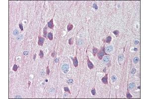 Image no. 3 for anti-Lysosomal-Associated Membrane Protein 1 (LAMP1) (Center) antibody (ABIN303277) (LAMP1 抗体  (Center))
