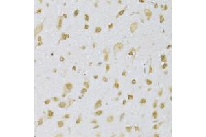 Immunohistochemistry of paraffin-embedded mouse brain using CBX8 Antibody (ABIN5973663) at dilution of 1/100 (40x lens). (CBX8 抗体)