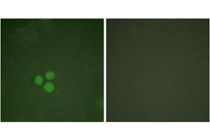 Immunofluorescence analysis of HeLa cells, treated with Forskolin (40nM, 30mins), using DP-1 antibody. (TGM4 抗体  (C-Term))