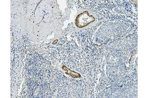 IHC analysis of VCL using anti-VCL antibody (ABIN7599003). (Vinculin 抗体  (AA 1-149))