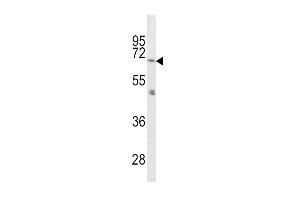 Western Blotting (WB) image for anti-Proprotein Convertase Subtilisin/kexin Type 2 (PCSK2) (AA 87-116), (N-Term) antibody (ABIN391908)