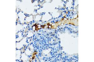 Immunohistochemistry (IHC) image for anti-Fibrinogen alpha Chain (FGA) antibody (ABIN7267177)