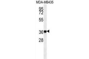 Western Blotting (WB) image for anti-Exonuclease 5 (EXO5) antibody (ABIN2995666) (EXO5 抗体)