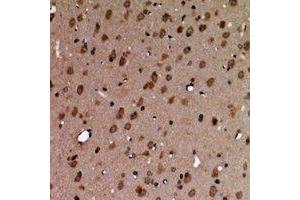 Immunohistochemical analysis of AAK1 staining in human brain formalin fixed paraffin embedded tissue section. (AAK1 抗体)