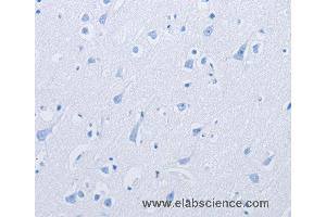 Immunohistochemistry of  using KCNMB3 Polyclonal Antibody at dilution of 1: (KCNMB3 抗体)