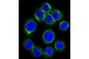 Immunofluorescence (IF) image for anti-Erythropoietin Receptor (EPOR) antibody (ABIN2998915) (EPOR 抗体)
