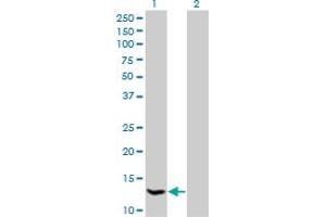 Western Blot analysis of HSPC152 expression in transfected 293T cell line by HSPC152 monoclonal antibody (M09), clone 3E5. (TRMT112 抗体  (AA 1-125))