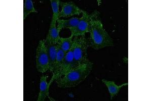 Immunofluorescent analysis of Hela cells using ABIN7176612 at dilution of 1:100 and Alexa Fluor 488-congugated AffiniPure Goat Anti-Rabbit IgG(H+L) (ZKSCAN3 抗体  (AA 8-275))