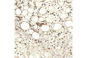 IHC analysis of SLC9A3R2 using anti-SLC9A3R2 antibody (ABIN7599271).