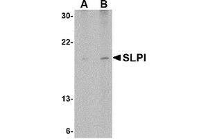 Western Blotting (WB) image for anti-Secretory Leukocyte Peptidase Inhibitor (SLPI) (Middle Region) antibody (ABIN1031101) (SLPI 抗体  (Middle Region))