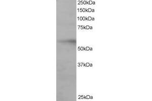 Western Blotting (WB) image for anti-Interferon Regulatory Factor 6 (IRF6) (C-Term) antibody (ABIN2465855) (IRF6 抗体  (C-Term))