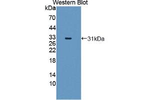 Western Blotting (WB) image for anti-Myosin, Light Chain 6B, Alkali, Smooth Muscle and Non-Muscle (MYL6B) (AA 5-199) antibody (ABIN5013972)