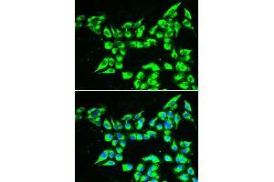 Immunofluorescence analysis of A549 cell using KLK10 antibody. (Kallikrein 10 抗体)