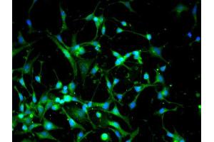 Immunofluorescence (Cultured Cells) (IF (cc)) image for anti-DNA (Cytosine-5-)-Methyltransferase 3 alpha (DNMT3A) (AA 26-100) antibody (ABIN669336)