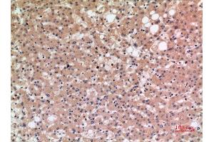 Immunohistochemistry (IHC) image for anti-Solute Carrier Family 10 (Sodium/bile Acid Cotransporter Family), Member 1 (SLC10A1) (C-Term) antibody (ABIN3187880)