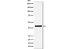 Western blot analysis of Aldolase expression in A549 cell lysate.