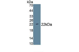 Detection of Recombinant CD276, Human using Monoclonal Antibody to Cluster Of Differentiation 276 (CD276) (CD276 抗体  (AA 47-219))