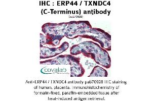 Image no. 2 for anti-Endoplasmic Reticulum Protein 44 (ERP44) (C-Term) antibody (ABIN1734140) (ERP44 抗体  (C-Term))