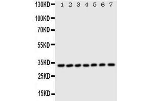 Western Blotting (WB) image for anti-Enoyl-CoA Delta Isomerase 1 (ECI1) (AA 272-290), (C-Term) antibody (ABIN3044153) (DCI 抗体  (C-Term))