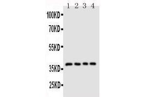 Anti-CD1d antibody, Western blotting Lane 1: COLO320 Cell Lysate Lane 2: HELA Cell Lysate Lane 3:  Cell Lysate Lane 4: JURKAT Cell Lysate (CD1d 抗体  (N-Term))