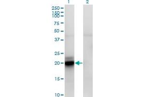 Western Blotting (WB) image for anti-Acyl-CoA Thioesterase 9 (Acot9) (AA 1-212) antibody (ABIN565123)